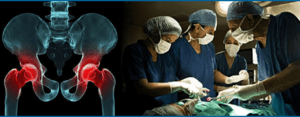 Total Knee Replacement in Ahmedabad, Gujarat – Sarthak Orthopedic Hospital